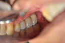 %_tempFileNameImplant%20124c6%