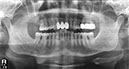 %_tempFileNameImplant%20124d1%