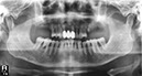 %_tempFileNameImplant%20124d2%