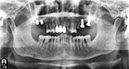 %_tempFileNameImplant%20124d3%