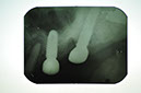 %_tempFileNameImplant%20124d4%