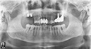 %_tempFileNameImplant%20124d5%