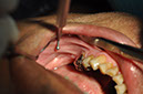 %_tempFileNameImplant%20125a1%