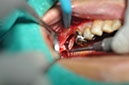 %_tempFileNameImplant%20125a2%