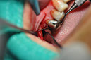 %_tempFileNameImplant%20125a3%