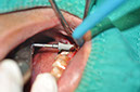 %_tempFileNameImplant%20125a5%