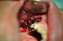 %_tempFileNameImplant%20125a7%