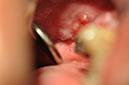 %_tempFileNameImplant%20125b1%