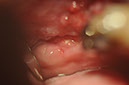 %_tempFileNameImplant%20125b3%