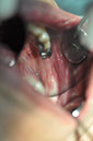 %_tempFileNameImplant%20125b4%