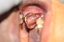 %_tempFileNameImplant%20125b5%