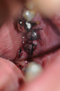 %_tempFileNameImplant%20125c1%