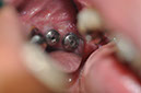 %_tempFileNameImplant%20125c2%