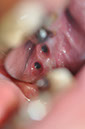 %_tempFileNameImplant%20125c3%