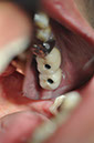 %_tempFileNameImplant%20125c4%