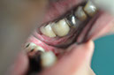 %_tempFileNameImplant%20125c5%