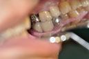 %_tempFileNameImplant%20125c6%