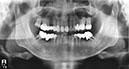 %_tempFileNameImplant%20125d1%