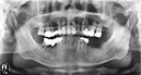 %_tempFileNameImplant%20125d2%