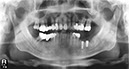 %_tempFileNameImplant%20125d3%