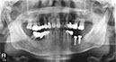 %_tempFileNameImplant%20125d4%
