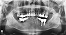 %_tempFileNameImplant%20125d5%