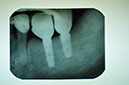 %_tempFileNameImplant%20125d6%