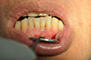 %_tempFileNameImplant%20126a1%