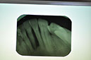 %_tempFileNameImplant%20126a2%