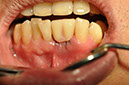 %_tempFileNameImplant%20126a3%