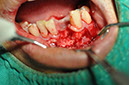 %_tempFileNameImplant%20126a4%