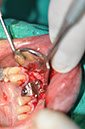 %_tempFileNameImplant%20126a6%