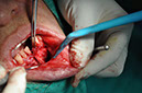 %_tempFileNameImplant%20126a7%