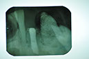 %_tempFileNameImplant%20126a8%
