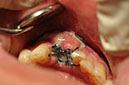 %_tempFileNameImplant%20126a9%