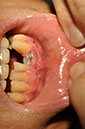 %_tempFileNameImplant%20126b1%