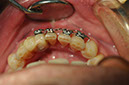 %_tempFileNameImplant%20126b3%