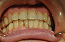 %_tempFileNameImplant%20126b6%