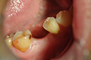 %_tempFileNameImplant%20127a1%