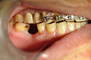 %_tempFileNameImplant%20127a2%