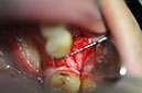 %_tempFileNameImplant%20127a3%
