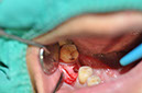 %_tempFileNameImplant%20127a4%