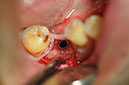 %_tempFileNameImplant%20127a6%
