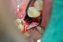 %_tempFileNameImplant%20127a9%