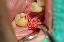 %_tempFileNameImplant%20127b1%