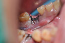 %_tempFileNameImplant%20127b2%
