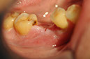 %_tempFileNameImplant%20127b3%