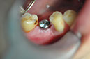 %_tempFileNameImplant%20127b5%