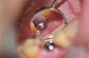 %_tempFileNameImplant%20127b6%