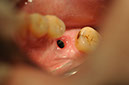 %_tempFileNameImplant%20127b8%